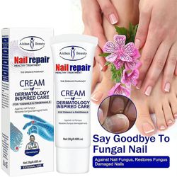 Hitoor 20g Nail Repair Cream Anti infeksjon Paronychia Grey Nail Repair Foot Antifungal Nail Treatment Crea