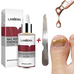 15ml nagelreparationsessens Ta bort onykomykos Serumsvampbehandling