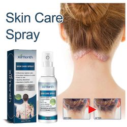 Psoriasis Treatment Spray Scalp Recovery Therapy, Scalp Psoriasis Treatment Spray, Skin Recovery Psoriasis Control Moisturizing Spray 1pcs