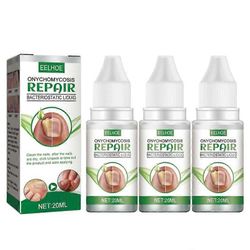 3kpl eteerinen öljy kynsien sieni korjausneste