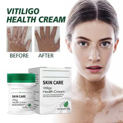 White Spot Remover Cream, Whitening Fade Cream Lightening Cream for intime områder, underarmene, armhulen, knærne, albuene og innsiden av låret, Bo...