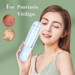 UVB ultraviolettivalohoitoväline vitiligohoito hoito ultraviolettilamppu laser psoriaasilamppu valohoito vitiligo EU-pistoke 220V
