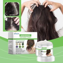 Seborrooinen dermatiittivoide, nopeasti vaikuttava seborrooinen dermatiitti päänahan hoito, antaa mukavuutta ja helpotusta kuivalle ja kutiavalle p...