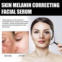 Hud Melanin Korrigerende Facial Serum, Melanin Correcting Serum, Dark Spot Corrector Daily Face Serum 1 Pcs