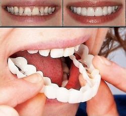 Pari ylä- ja heikompilaatuista hammasproteesia välitön hymyn mukavuus sopii Flex Kosmeettiset hampaat Hammasproteesihampaat Top Cosmetic Viilu Kork...
