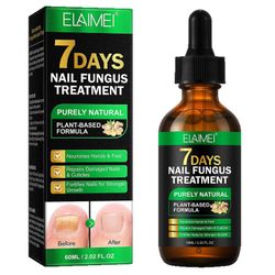 Kynsisienen hoito, Inkiväärikynsisienen hoito, 7 päivän kynsisienen hoito varpaankynnelle
