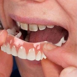Ohuet väärennetyt hammasviilut Silic Soft Safe Denture Mukavat hampaat Oikomishoito