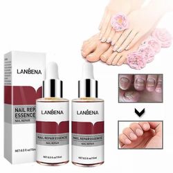 1-3kpl Lanbena Nail Repair Essence Poista Onychomycosis seerumin sienihoitotiedosto