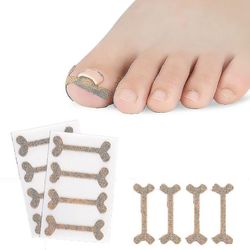 Mikasa 4 Pack tå søm groove fod søm ortodontisk enhed tommelfinger negleplaster hurtig pedicure tå søm