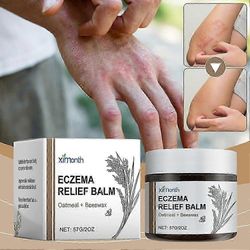 Eczemas Relief Cream Skin Redness Relief kutinaa estävät voiteet kaikille ihotyypeille 1kpl