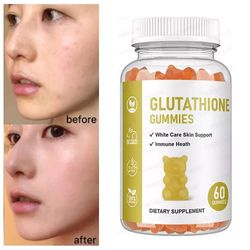 Glutathion gummier med hyben, niacinamid og vitaminer 3 pcs