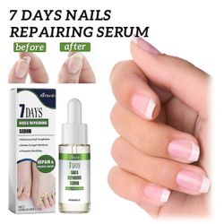 7 päivän kynsien kasvu ja vahvistava seerumikynsi, kynsiseerumin korjausesanssi, kynsinauhojen kynsinauhaöljyn vahvistaja vaurioituneiden kynsien k...