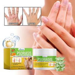 unbrand Ihonhoitovoide, psoriaasin hoitovoide, lievittää kehon ihon kutinaa, punaista kipua, kosteuttavaa ihoa kutinaa estävä hoitovoide 3pcs