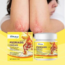 Herbal Psoriasis & Eczema Relief Cream kutinaa ehkäisevä, rauhoittava ja kosteuttava allantoiini- ja luonnollisilla uutteilla herkälle iholle 1pc