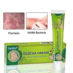 Psoriaasivoide Ekseema Voide Psoriasis Käsi Jalka Versicolor Estää Dermatiitti Sieni Kutina