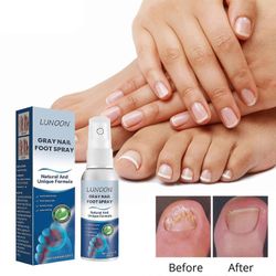 Puhdistus Antifungals kynsihoidot Spray in Medicals laatu, 30 ml, Antifungals kynsihoidot, Antifungals spray 30ml