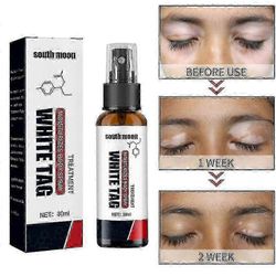 Vitiligo-hoito Spr