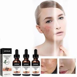 3kpl uutta melaniinia korjaavaa kasvoseerumia, tummaa korjaavaa seerumia, tummaa korjaavaa seerumia päivittäin, ikääntymistä estävää kasvoseerumia tw