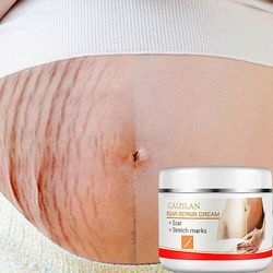 Stretch Maternity Repair Cream Fjern graviditet arr Akne Cream Anti-aldring Anti Winkles