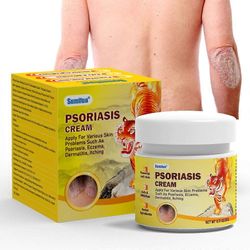 unbrand Psoriasishoitovoide, ihon psoriasiksen kutinaa lievittävä rauhoittava voide, rauhoittava ja kosteuttava koostumus punoitukseen ja epämukavu...