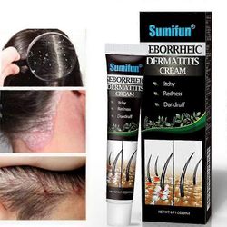 Psoriaattisen seborrooisen dermatiitin hoito kerma pää akne kutina päänahka silsa korjata iho puhdistusvoide hiukset päänahan hoito 1pc