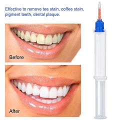 5 ml 35% väteperoxid Dubbelfat Dental Bleaching Oral Care Tandblekning Tandblekning Gel