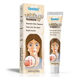 Vitiligo poistovoide Vitiligo Puhdistusvoide Kasvojenhoito Voide Ihonhoito