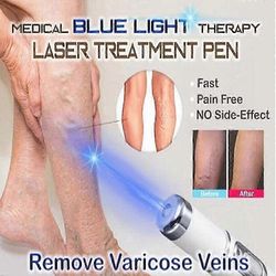 Spider Vein Eraser Blue Light Therapy Wrinkle Akne Laser Pen Soft Scar Removal