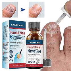 Kynsien korjausratkaisu Nopeasti imeytyvä kynsiä vahvistava neste miehille naisille 3pcs