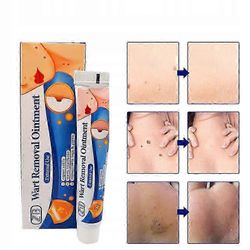 Yrttiuute voide ihon hoitoon – terävät kondyloomat tavalliset syylät herpes