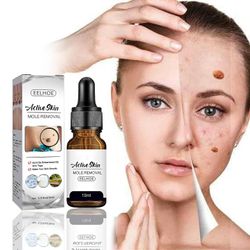 Skin Tag Remover Superstar stark hud tag remover serum gjord av naturliga växtextrakt för ansikte och kropp