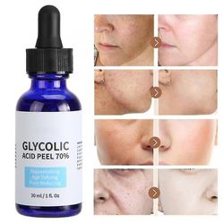 Glykolikuorinta ja nesteen kutistuvien huokosten ja ihon sävyn korjaaminen, parantaa