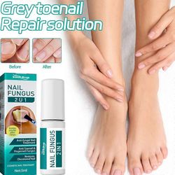 Kynsisienihoito varpaankynsille Erittäin vahva kynsisienihoito anti