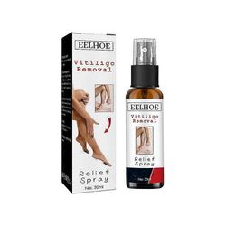 Paras Vitiligo Removal Relief Spray Vitiligo Skin Repair Spray ihonhoitoon