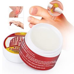 Joint smerte salve 10g, aktivere muskler bein for å lindre foten, tommelen, ankelleddet stivhet, smerte, rødhet hevelse Care Cream 1pc