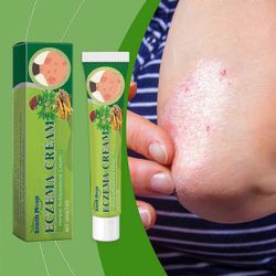 20g kasviperäinen ekseema voide, kasviperäinen psoriaasivoide, anti-inflammatorinen ja bakterisidinen voide, korjaa vaurioitunut ihon este 3 kpl