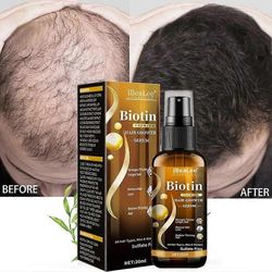 Till Biotin Hair Growth Spray Anti Hair Loss Fast Regrowth Scalp Treatment Serum