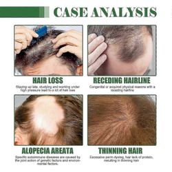 100 % puhdasta batanaöljyä hiusten kasvuun Luonnollinen päänahan hoito Ravitseva öljy paksummille, vahvemmille hiuksille ja vähentää hiustenlähtöä ...