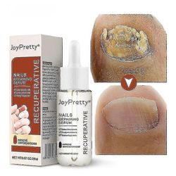 1/2/3kpl onychomycosis nestemäinen kovera ja kupera karkea kynsipiste onychomycosis pehmeä kynsien korjaus nestemäinen sormen reunaöljy kynsien kor...