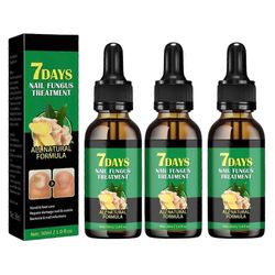 30ml Kynnet Hoito Korjaus Kynsien sieni Anti-sieni Onychomycosis-removal Liquid Ginger Jalka Antifungaalinen kynsihoito 3pcs