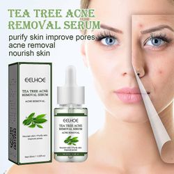 Th000 1pc Eelhoe 3-dagers Kojic Acid Moisturizing Cream lyser huden fuktighetsgivende krem strammer huden beautifying cream fades flekker