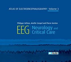 Atlas of electroencephalography - Volume 3: EEG - Neurology and critical care