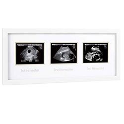 Pearhead P63016 - Estrutura de ultrassom trimestral, sem texto