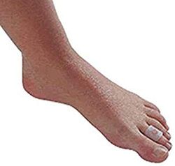 VARISAN Podiatry 1 Unit 150g