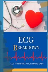 ECG BREAKDOWN: Made it easy- Pocket guide