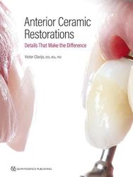 Anterior Ceramic Restorations: Details That Make the Difference