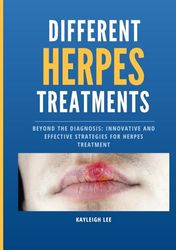 Different HERPES Treatments - Living With Herpes - For Those Recently Diagnosed: Beyond the Diagnosis: Innovative and Effective Strategies for Herpes ... Herpes - Oral Herpes - HSV 1 and HSV 2