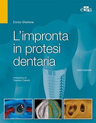 L'impronta in protesi dentaria