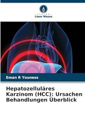 Hepatozelluläres Karzinom (HCC): Ursachen Behandlungen Überblick