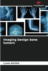 Imaging benign bone tumors